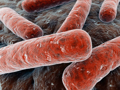 Mycobacterium tuberculosis